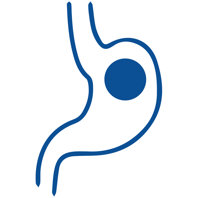 Post-intra Gastric Ballon