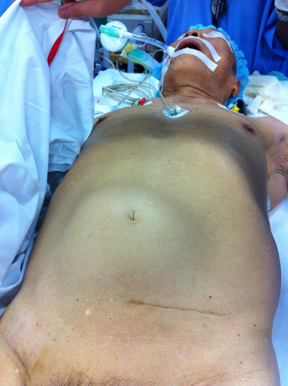 Figure 4. Pulsatile abdominal mass